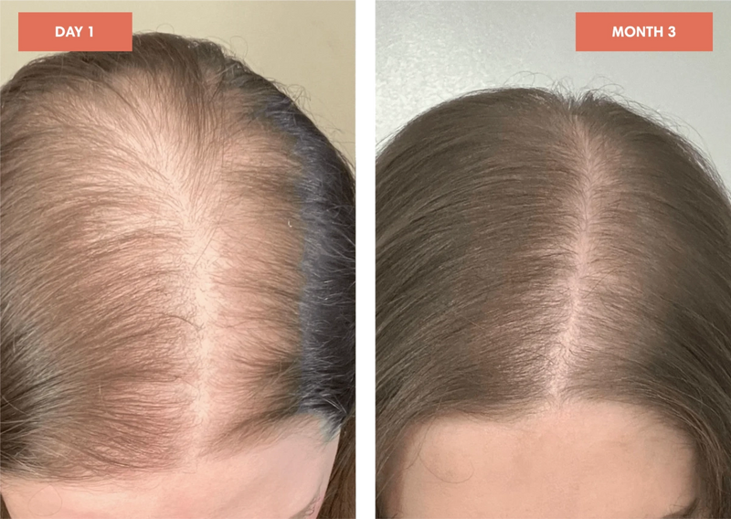 Before and After