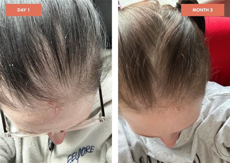 Before and After