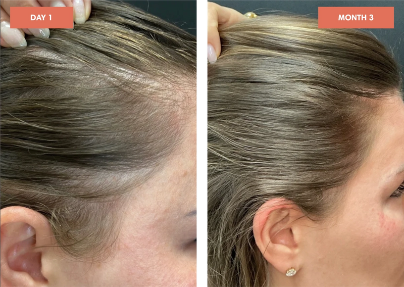 Before and After
